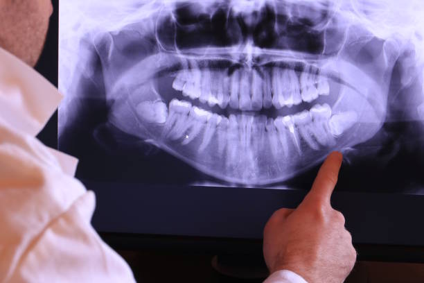 Best Emergency Treatment for Dental Infections or Abscesses in Washington, IL